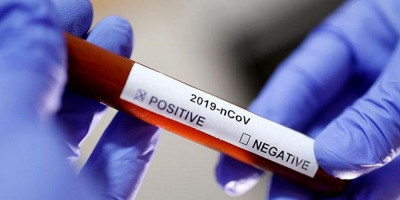 WNI Positif Virus Corona di Singapura, Ini Penjelasan Kemenlu 