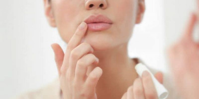 Cegah Jerawat Muncul di Bibir