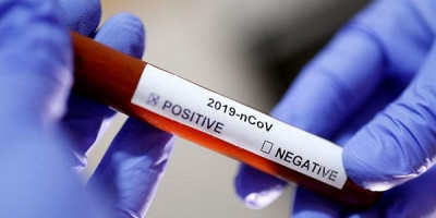 Mendeteksi Virus Corona dengan Eksperimen Tes Antibodi