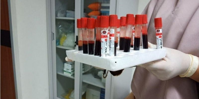 Jumlah Positif Corona Meningkat Melalui Hasil Rapid Test, Simak Penjelasannya 
