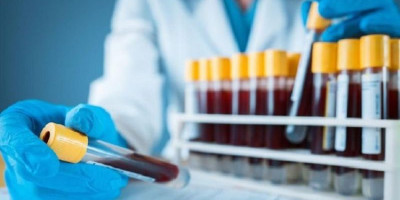 40.757 Orang Jalani Rapid Test, 114.196 Paket Bansos Dibagikan di Jakarta Barat