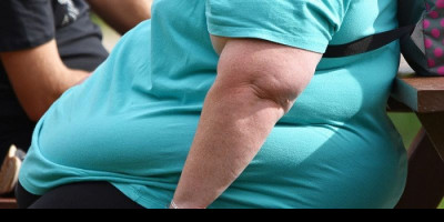 Hati-hati, Orang Obesitas Rentan Terinfeksi Corona 