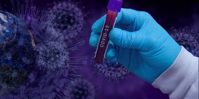 Ilmuan Italia Kembangkan Vaksin Virus Corona dari Antibodi Tikus