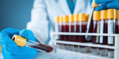 Akses Rapid Test dan Swab Test di Pesantren Sulit, Ini Solusinya