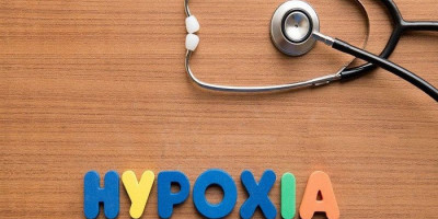 Mengenal Happy Hypoxia Sindrome, Gejala Baru Covid-19 yang Mematikan