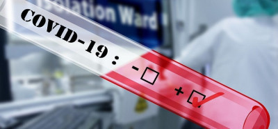 <i>Update</i> Covid-19: Kasus Baru Kembali Tembus di Atas 3.000
