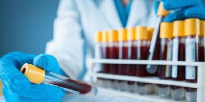 Kemenkes Cabut Aturan Rapid Test Sebagai Syarat Perjalanan, Ini Gantinya