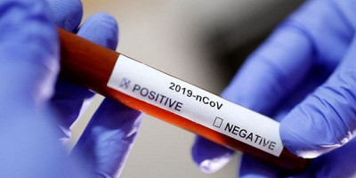 Harapan Baru Tangani Covid-19 Melalui Terapi Plasma Konvalesen