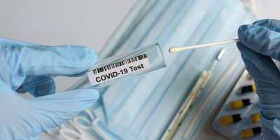 Disepakati, Segini Harga Tertinggi Rapid Test Antigen Swab