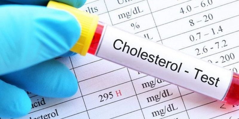 Kolesterol Bermanfaat Tapi Ada Batasnya