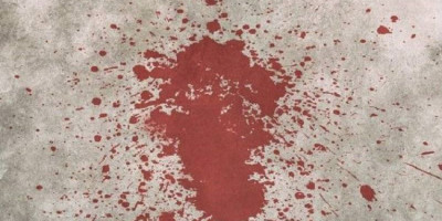 Leher Perawat Ini Disayat di Bandara Soetta hingga Pendarahan