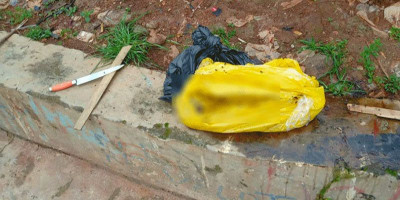 Ya Ampun, Potongan Kaki Siapa Dibungkus Plastik 