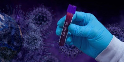 Kasus Covid-19 Terus Pecahkan Rekor Tertinggi, Ini Penyebabnya Kata Kemenkes