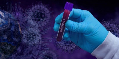 Kasus Sembuh Covid-19 di Atas 42 Ribu, Positif Naik Dibanding Kemarin