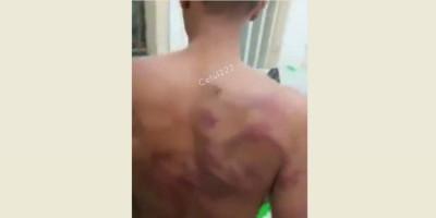 Napi Lapas Kelas 1 Medan Ngaku Diperas Rp40 Juta, Jika Tidak Dipukul Petugas Sampai Luka