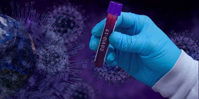 Pemerintah Bakal Percepat Hasil Tes RT-PCR di Pintu Masuk RI