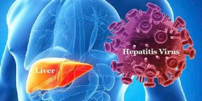 15 Kasus Terkait Hepatitis Akut Tunggu Hasil Pemeriksaan