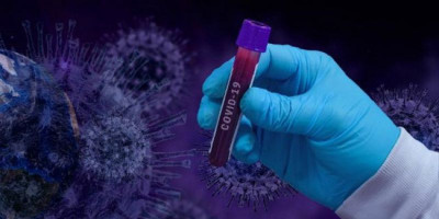 Covid-19 Akan Dianggap Seperti Flu Biasa, Biaya Berobatnya Bakal Ditanggung BPJS Kesehatan