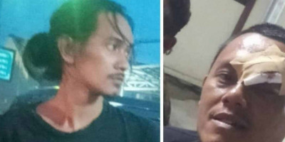  Biadab! Dua Wartawan di Karawang Dianiaya, PWI Jabar Desak Kepolisian Tangkap Pelaku