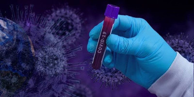 Di Tengah Waspada Global, Indonesia Tetap Tenang Hadapi Covid-19
