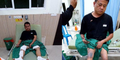 Serangan Brutal Air Keras, Aktivis Bangka Selatan Dirawat Intensif 